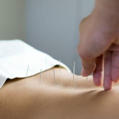 Acupuncturist Thumbnail